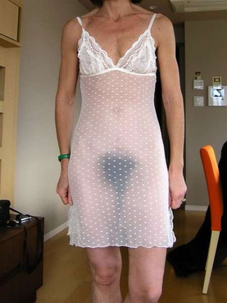  Des poils .... — photo 3