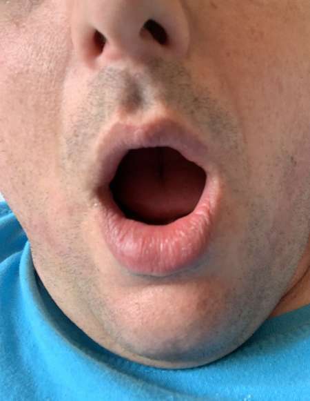 Bouche à gaver fond de gorge